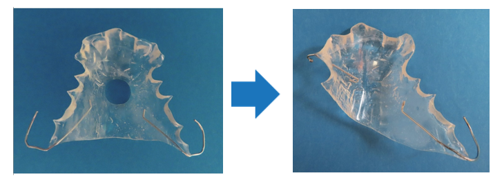 改良アムステルダム型左側片側ミニスプリント